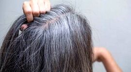 جلوگیری از سفید شدن موی سر با مصرف این ویتامین‌ها

