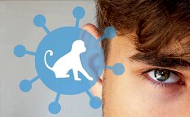 همه‌گیری نگران‌کننده آبله میمون


